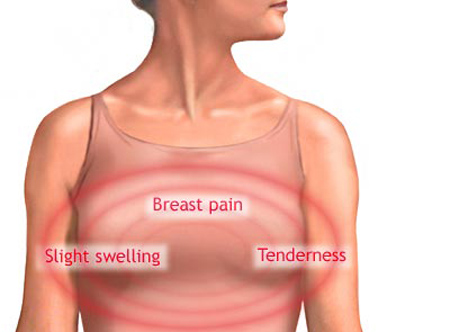 Breast Cancer Symptoms